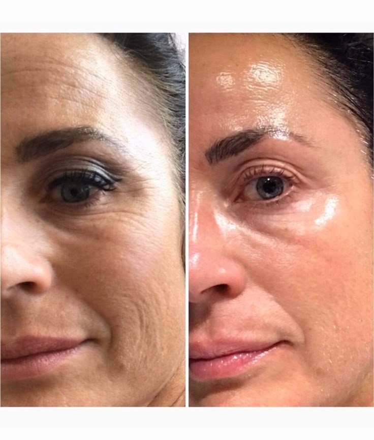 Before-and-after-Lumispa-use.jpg